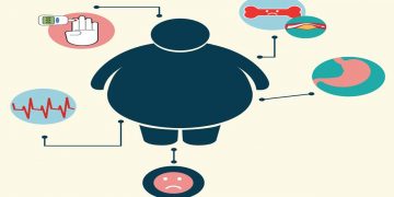 Cushingov sindrom – potencijalni uzrok pretilosti